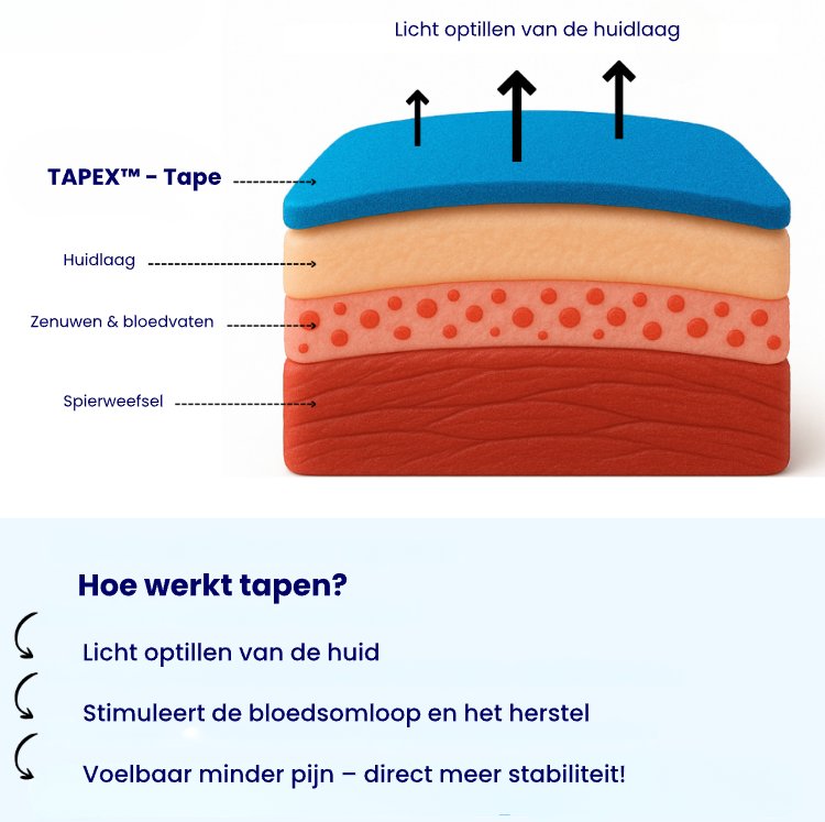 Hoe werkt kinesiotape - diagram van huidlagen